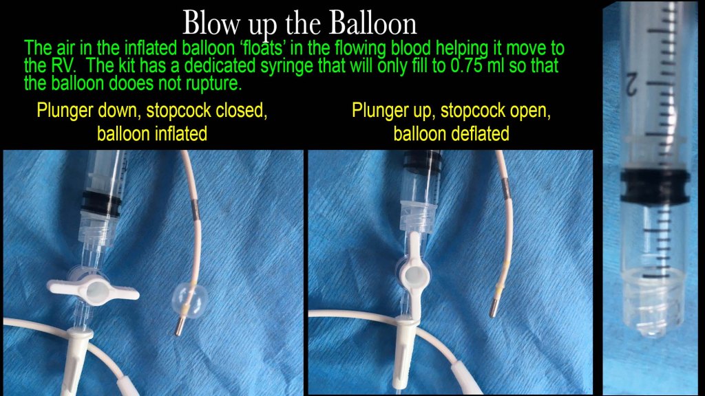 Transvenous Pacemaker | Searcy EM