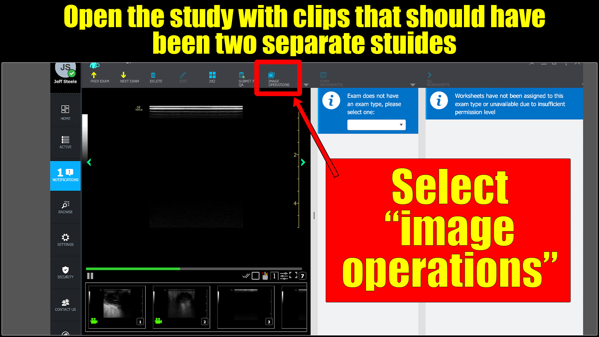 How to “split” studies | Searcy EM